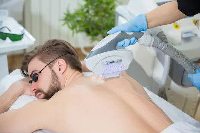 Laser Hair Removal Services in Kansas City